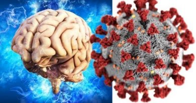 Mild COVID-19 infections can cause brain changes (1)