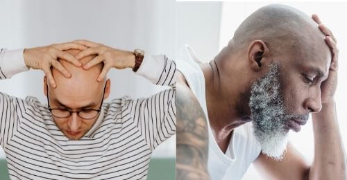 men heads bald